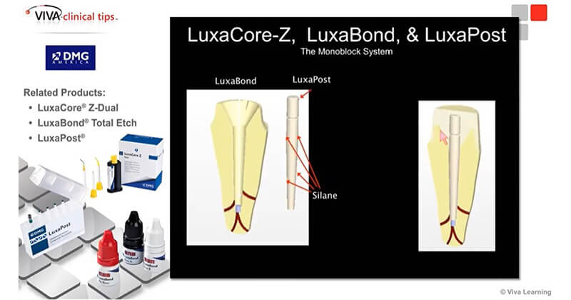 Dr. Gary Radz discusses creating a Monoblock System using LuxaCore® Z Dual, LuxaBond® Total Etch, and LuxaPost®.