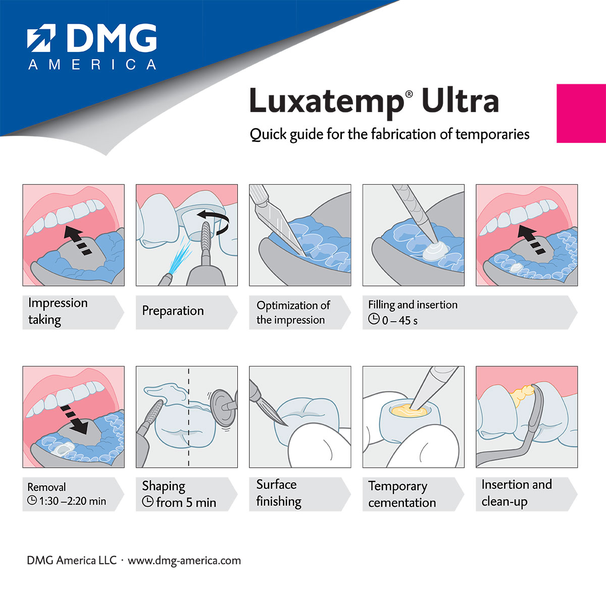 Quick Guide - Luxatemp Ultra