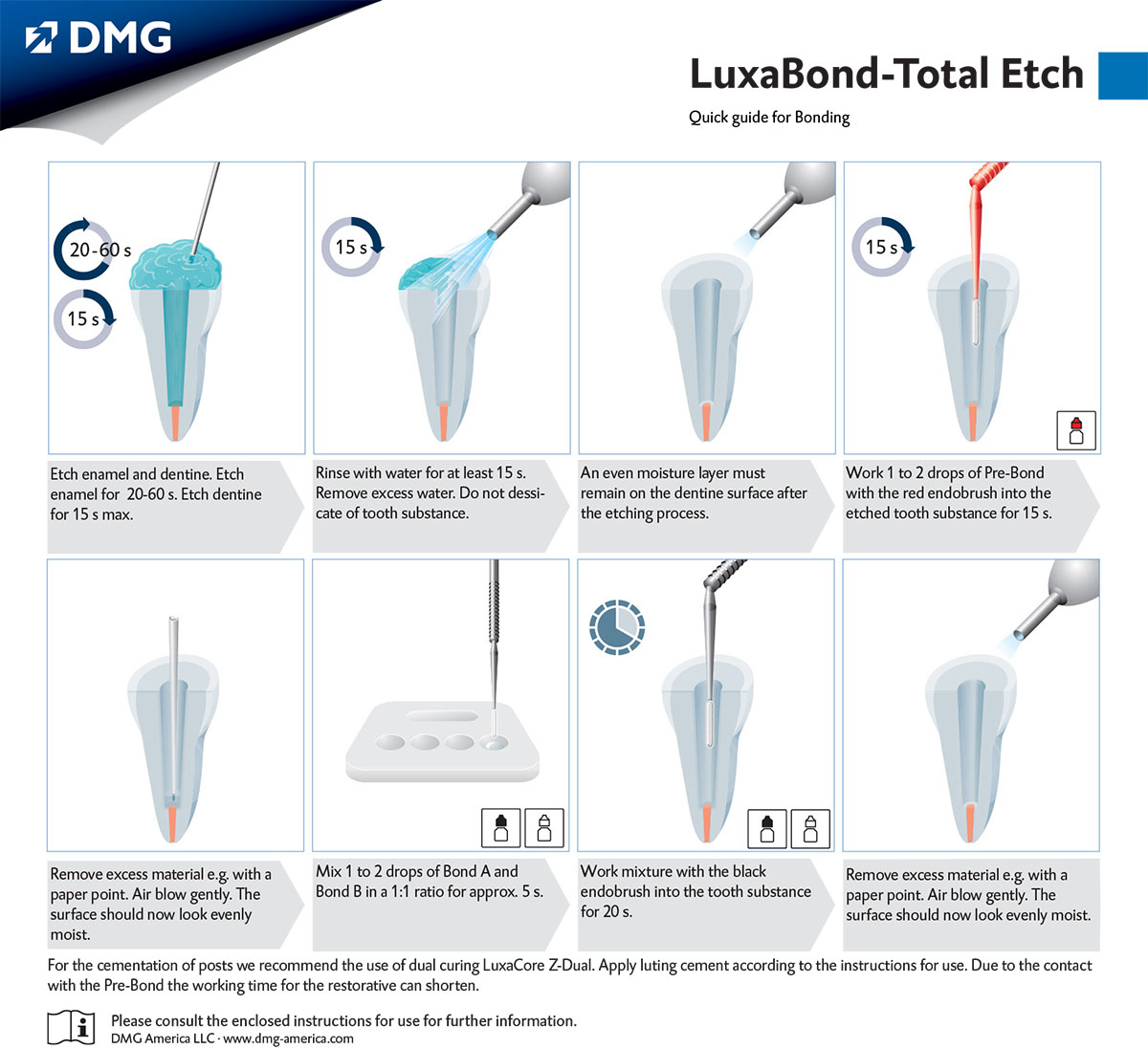 Quick Guide - LuxaBond-Total Etch
