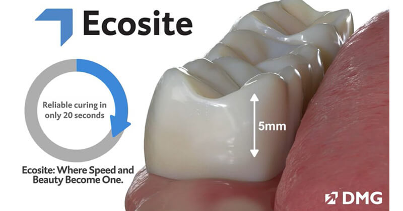 Ecosite Bulk Fill: one quick 20-sec light cure for reliable curing of 5mm fill.