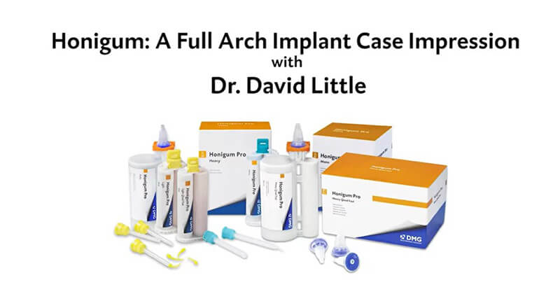 Honigum: A Full Arch Implant Impression with Dr. David Little