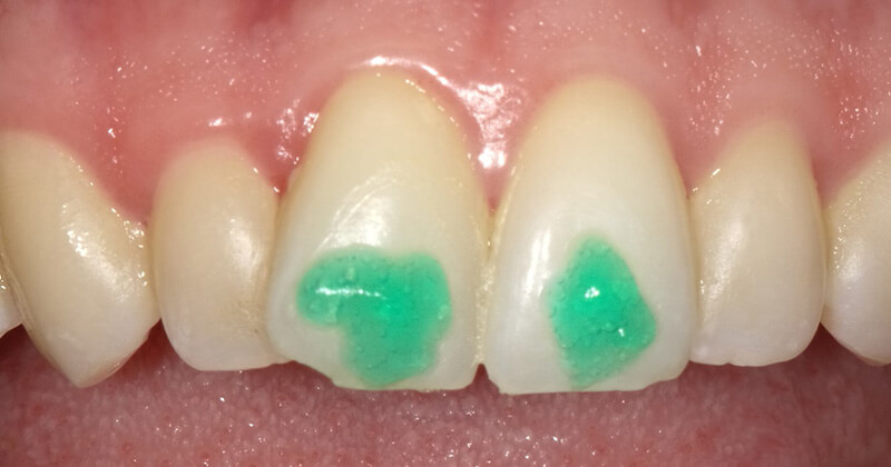 Icon Dental Patient & Client