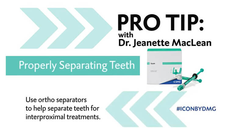 Icon Pro Tip with Dr. MacLean: How to Properly Separate Teeth