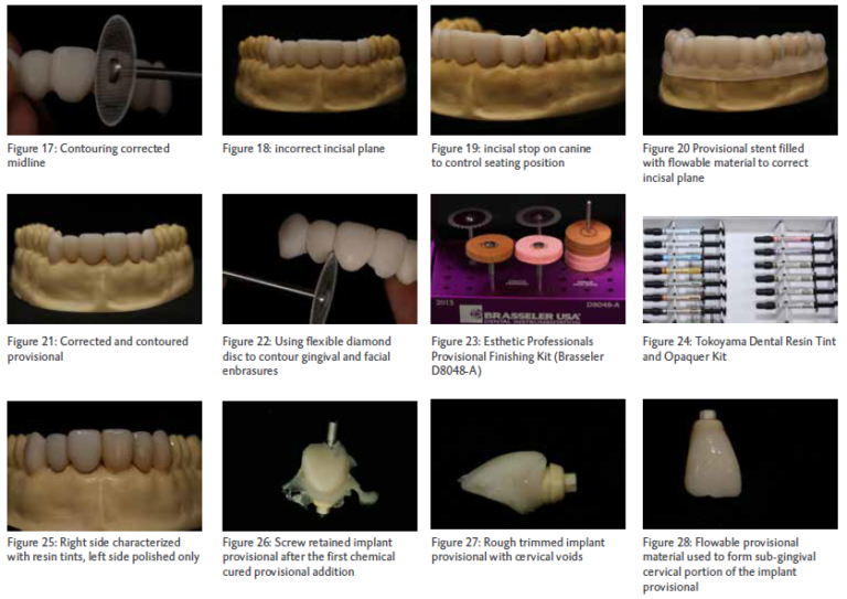 Techniques for Optimizing Provisional Restorations - DMG America