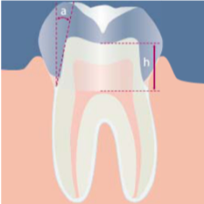 Prepare Tooth Core for PermaCem 2.0