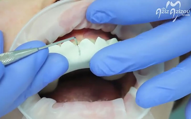 Dentist showing dental work on video
