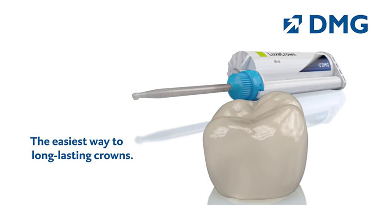 LuxaCrown - The easiest way to long-lasting crowns.