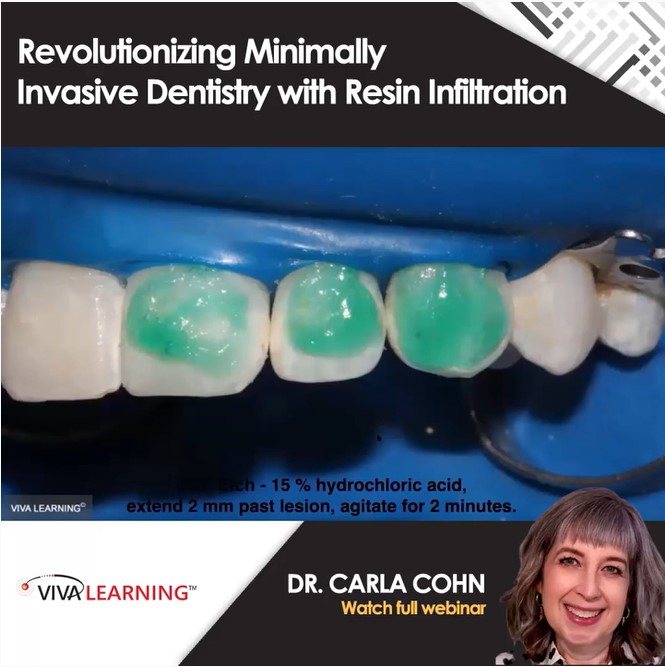 Clinical Tip Resin Infiltration DMG America
