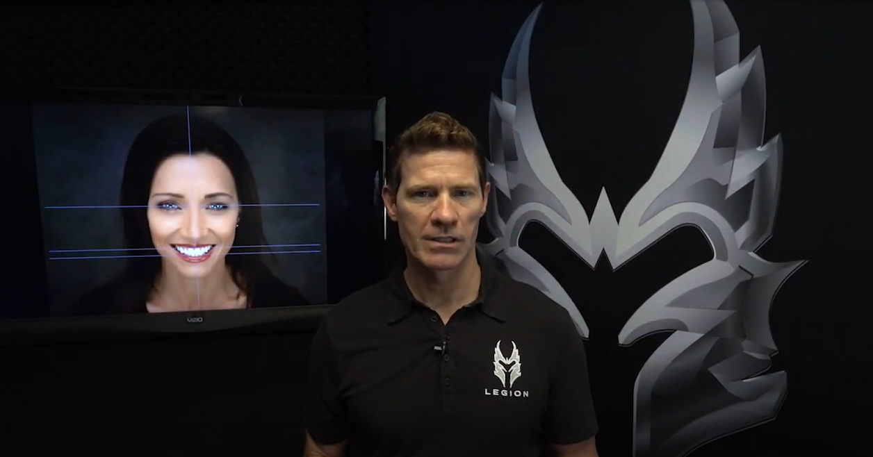 Smile Design With Dr Todd Snyder Part 4 Dmg America