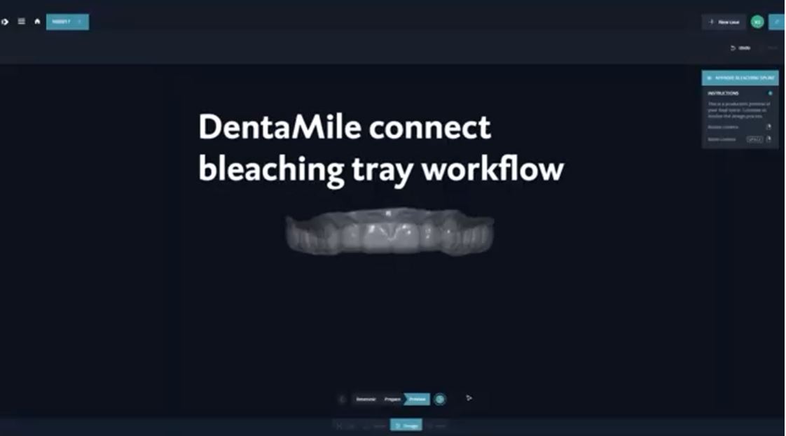 DentaMile Bleaching Tray Workflow DMG America